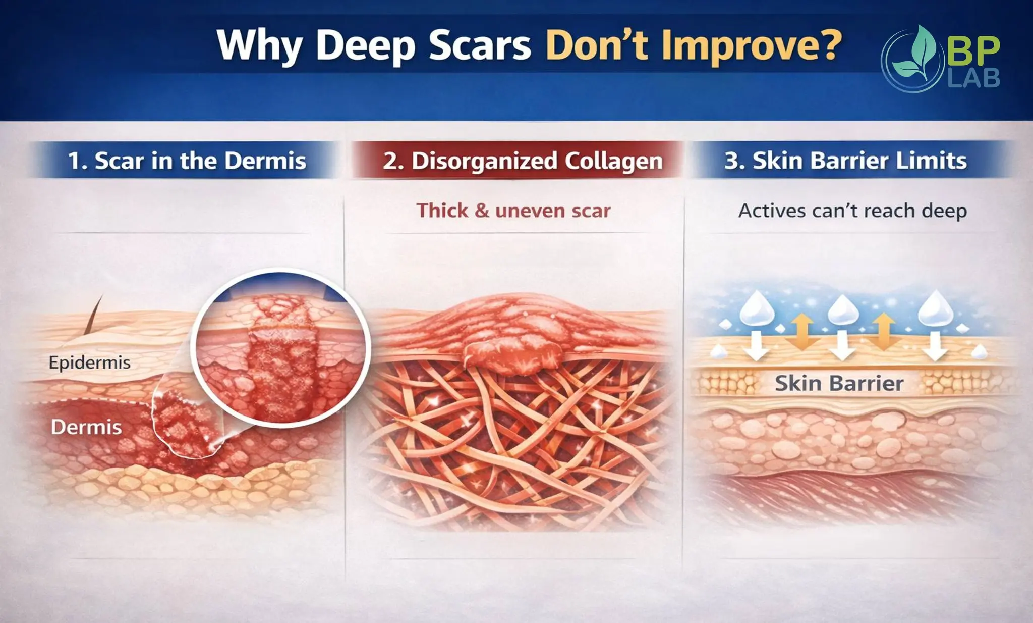 Reason why deep scars don't improve